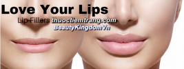 Tạo hình môi không phẫu thuật bằng Filler