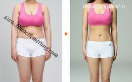 Bảng giá phẫu thuật hút mỡ