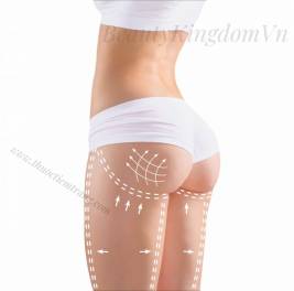 Phẫu thuật Thẩm Mỹ Nâng Mông